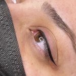 میکروبلیدینگ تخصصی