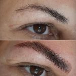 میکروبلیدینگ تخصصی